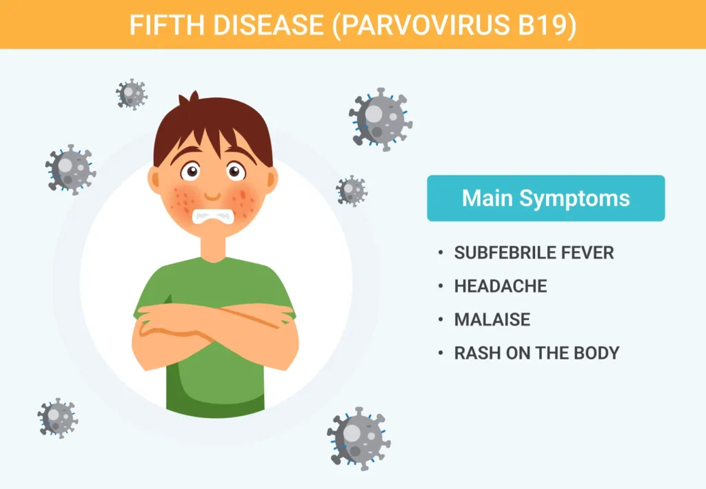 Fifth-Disease-Parvovirus-B19