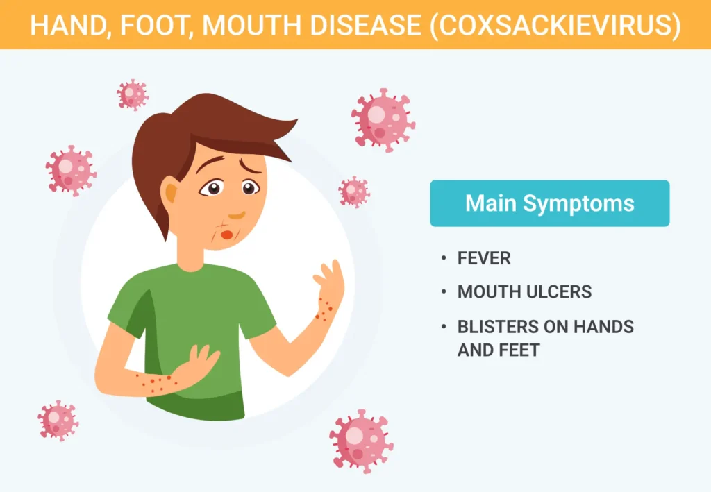 Hand-Foot-and-Mouth-Disease-Coxsackievirus